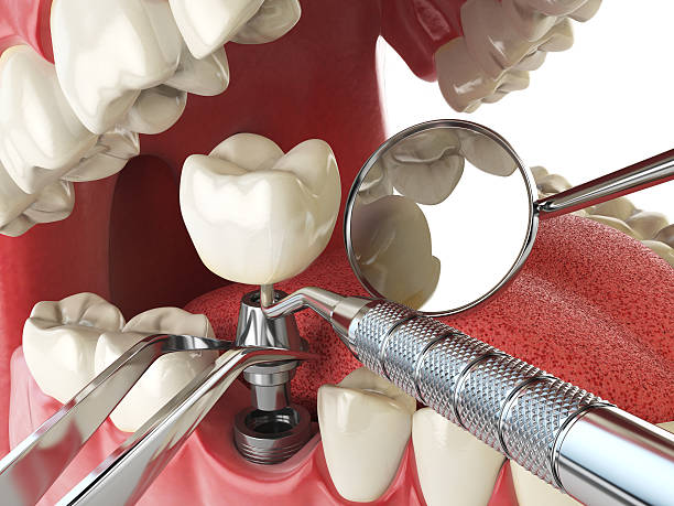 Best Emergency Denture Repair in Preston, ID